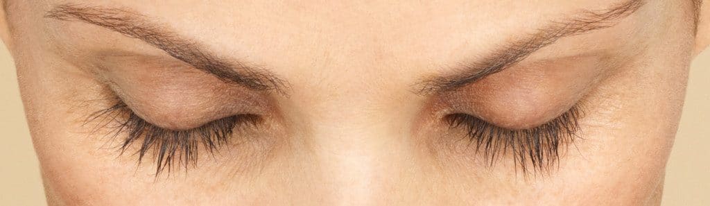 After Latisse treatment