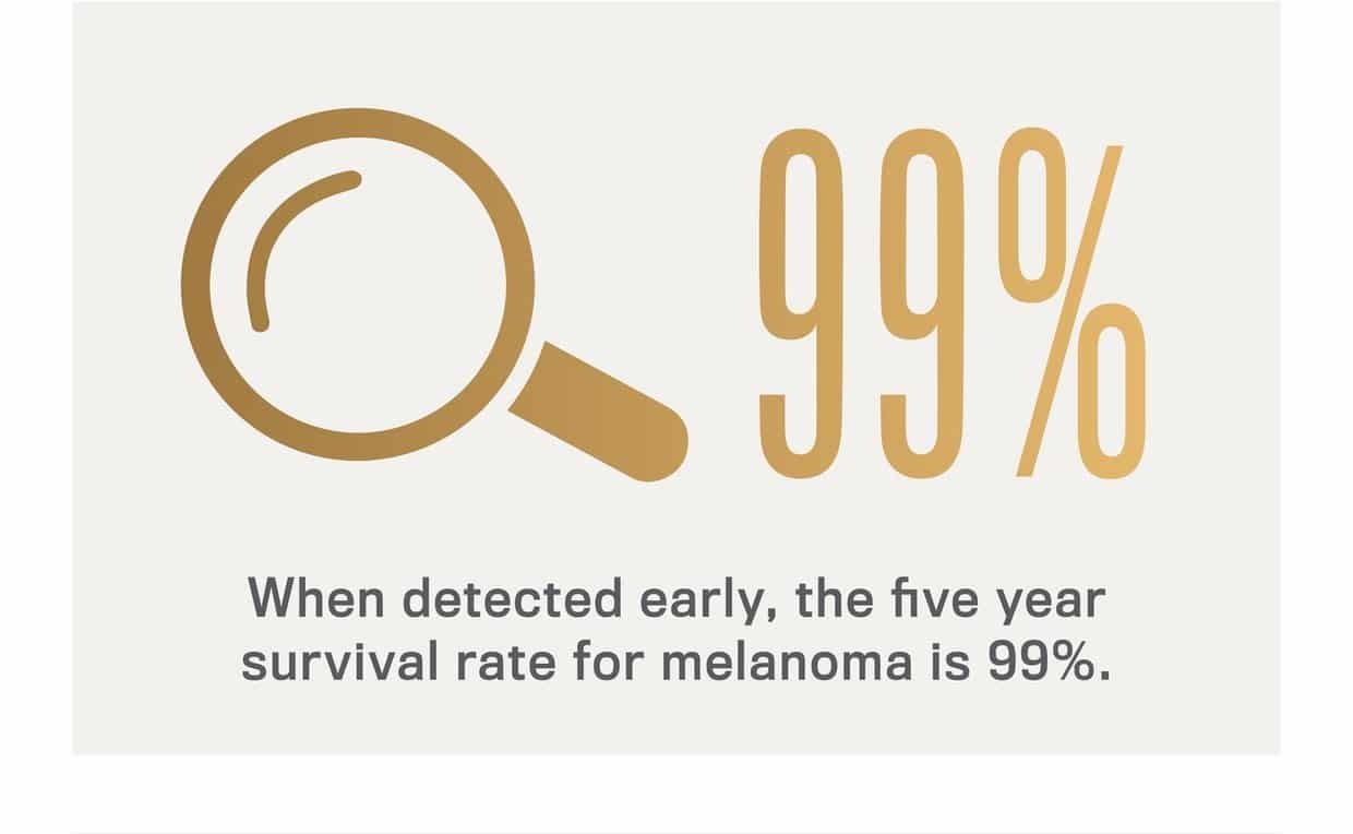 When detected early, the five year survival rate for melanoma is 99%