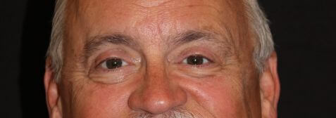 Eyelid Surgery before and after results - Nashville patient - after